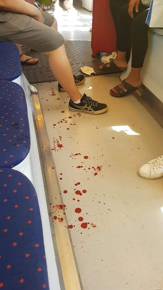 Sangue in tramvia